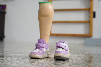 Eine Unterschenkel-Prothese steckt in einem von zwei Kinderschuhen in einem Rehazentrum