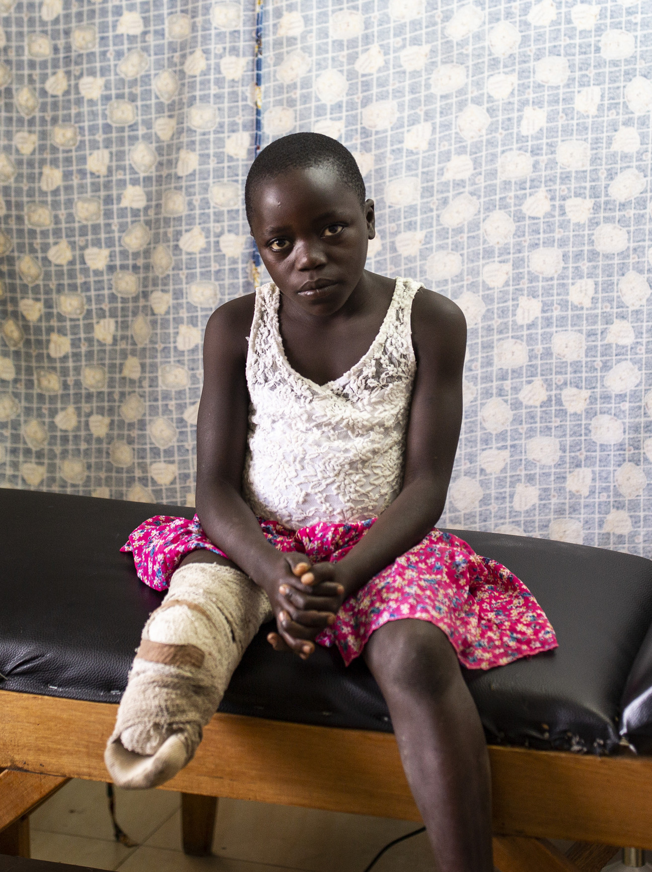 Mädchen, sitzend auf einer Liege, mit einem amputierten Bein